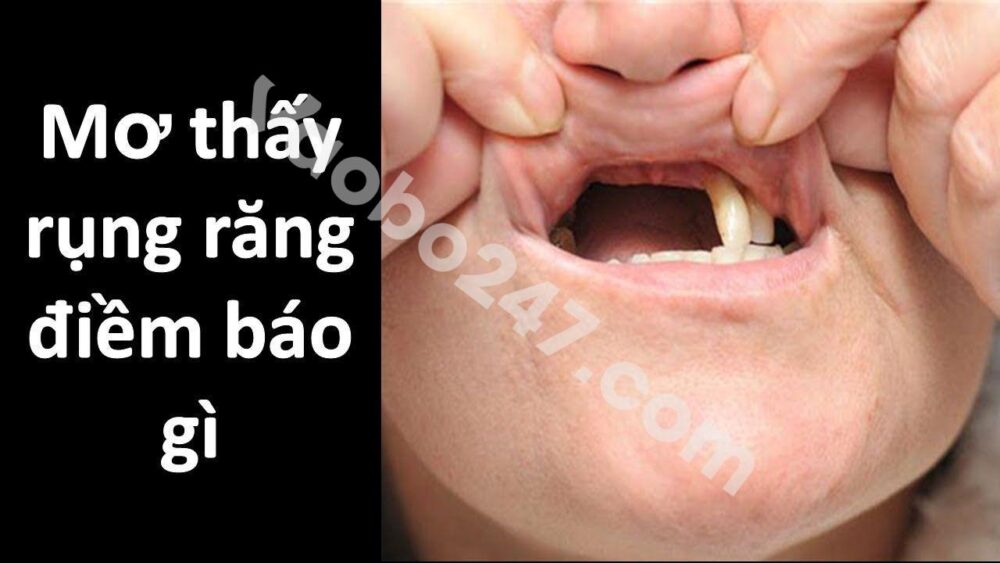 Nằm mơ thấy rụng răng có điềm báo gì? Giải mã giấc mơ